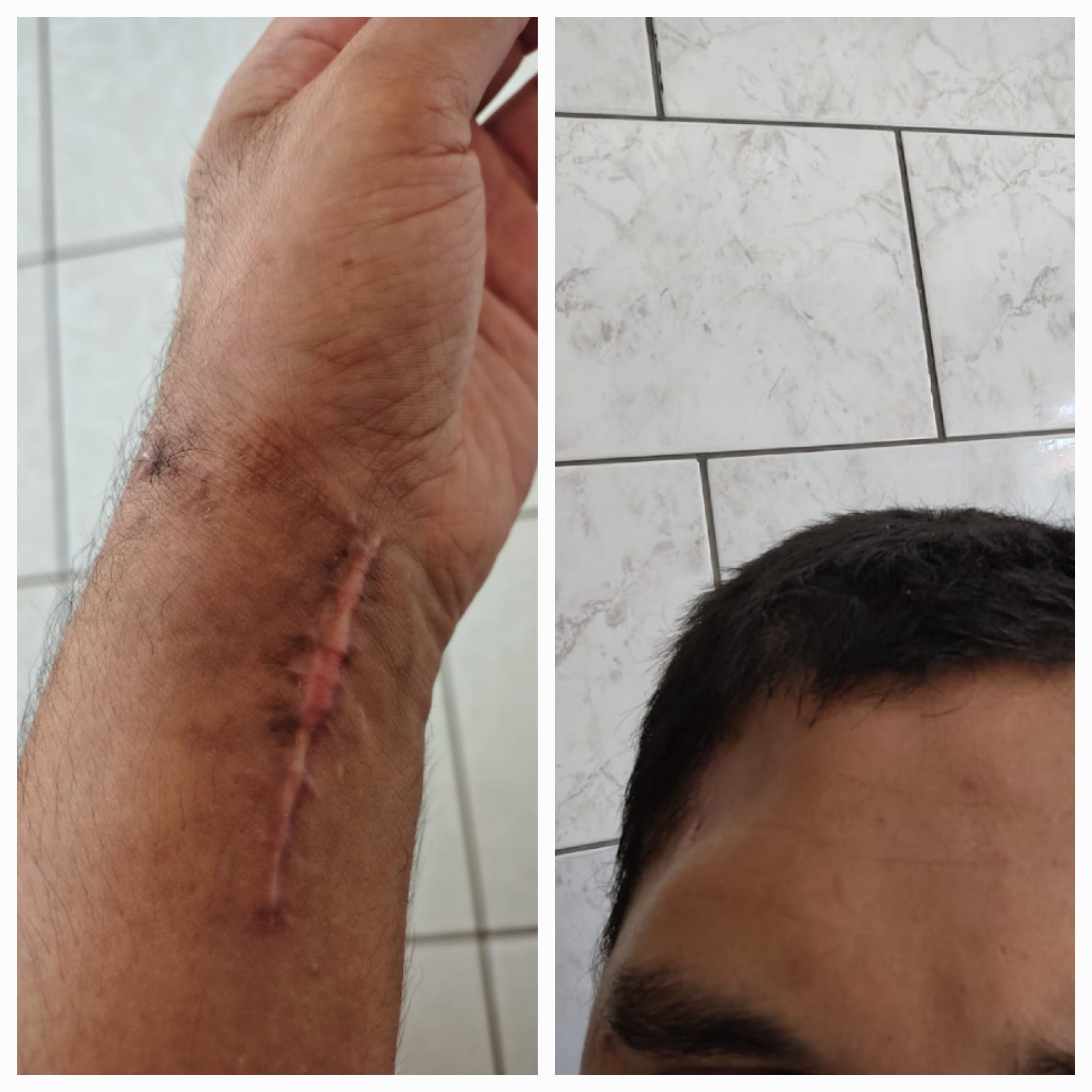 Pessoa beneficiada pela campanha